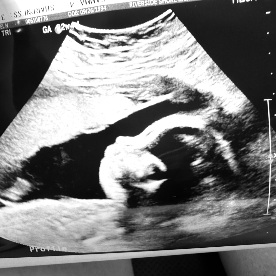 Photo shared by Rachel for their Babylist baby registry.