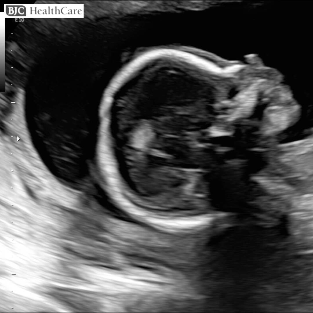 Photo shared by Megan for their Babylist baby registry.