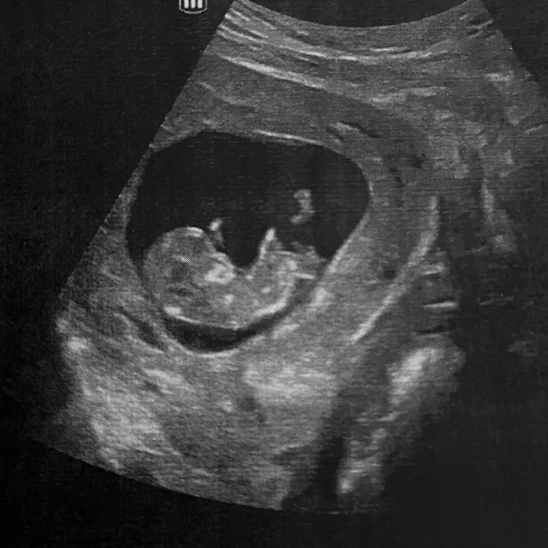 Photo shared by Anna for their Babylist baby registry.