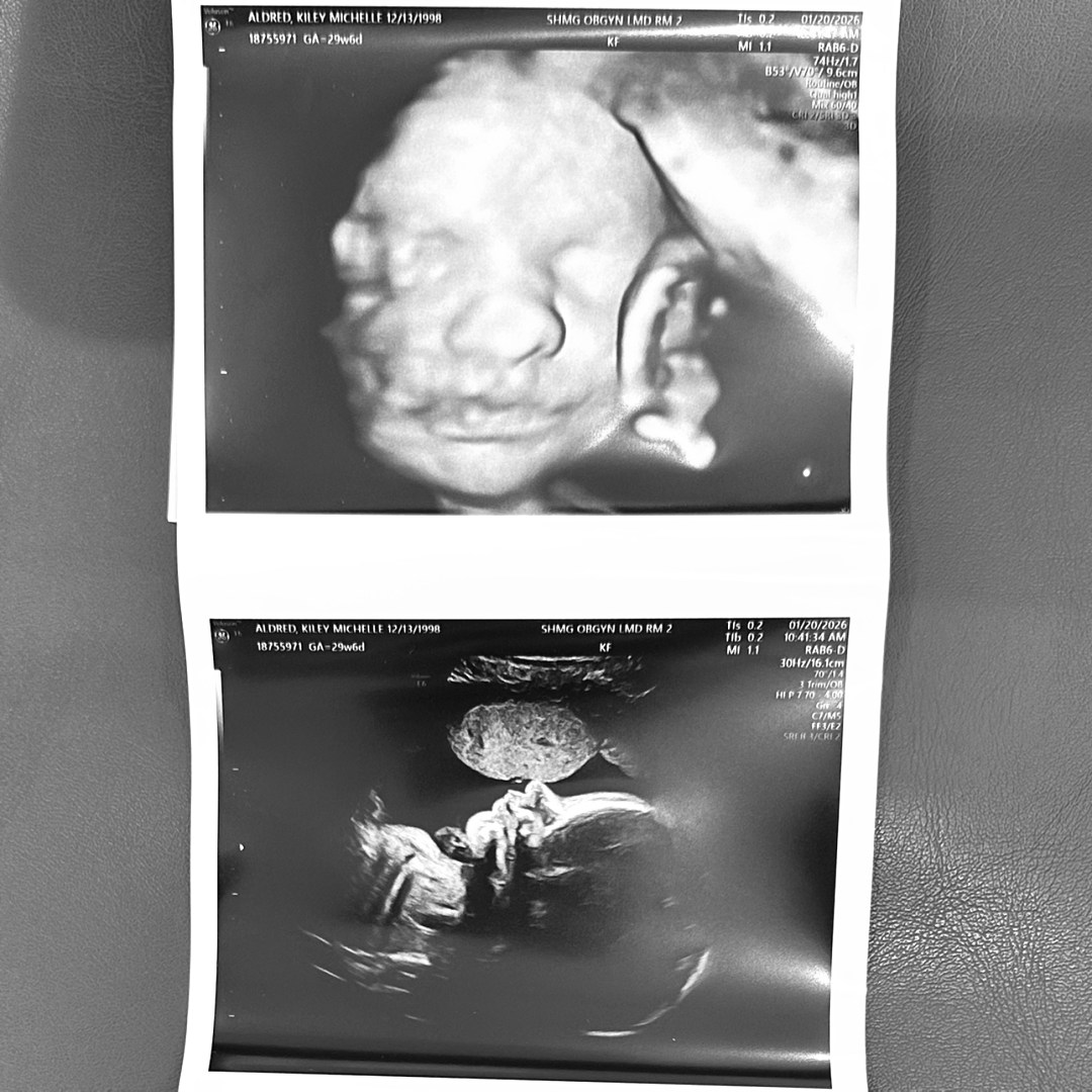 Photo shared by Kiley for their Babylist baby registry.