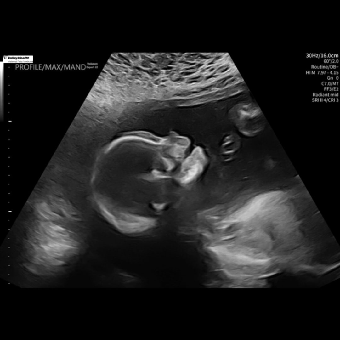 Photo shared by Ellie for their Babylist baby registry.