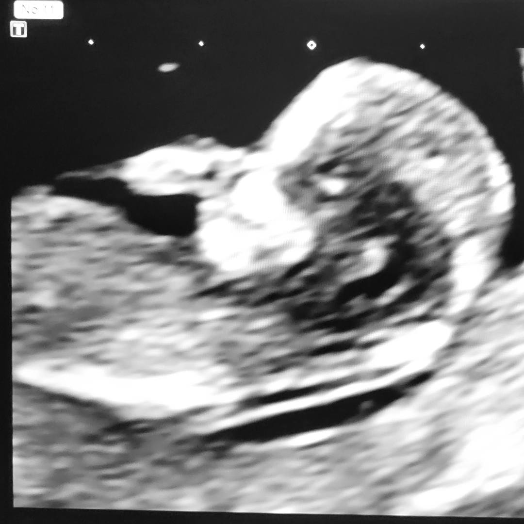 Photo shared by Jenna for their Babylist baby registry.
