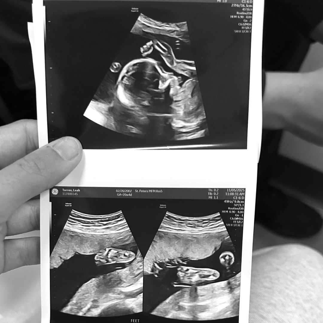 Photo shared by Leah for their Babylist baby registry.