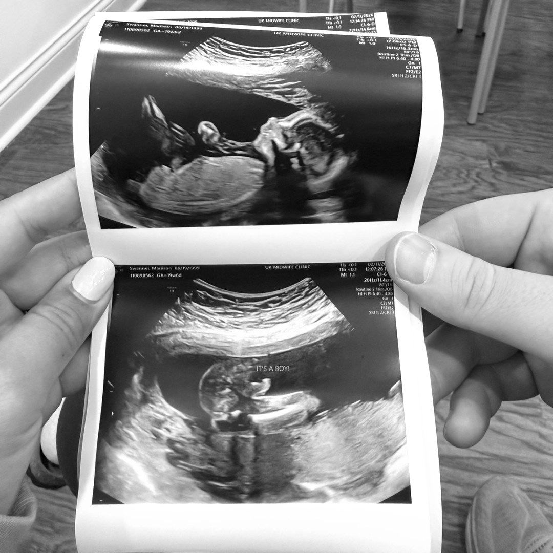 Photo shared by Madison for their Babylist baby registry.