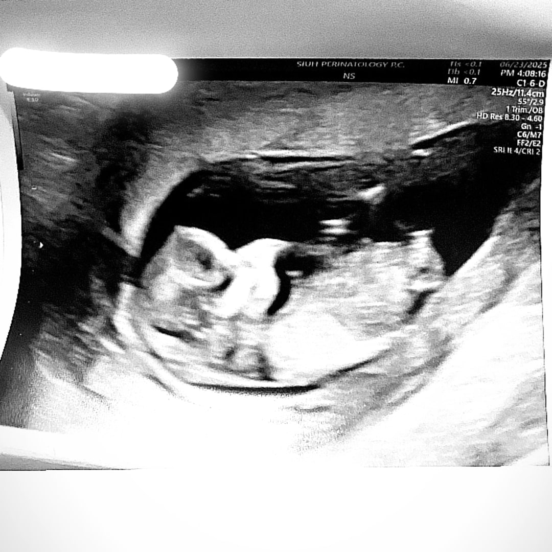 Photo shared by Dayja for their Babylist baby registry.
