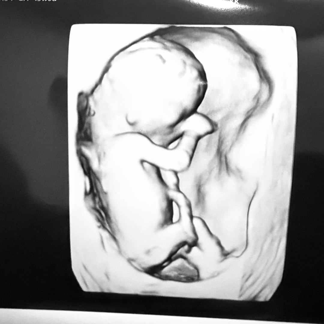 Photo shared by Brittni for their Babylist baby registry.