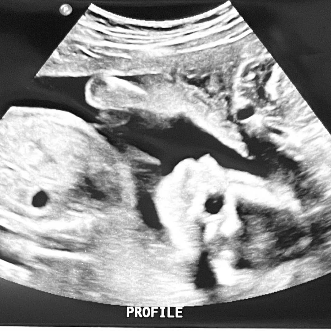 Photo shared by Leslie for their Babylist baby registry.