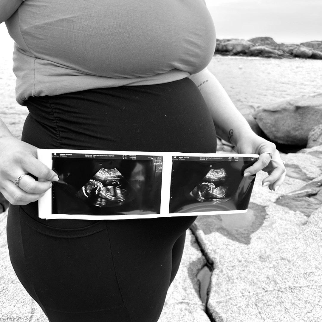 Photo shared by Amanda for their Babylist baby registry.