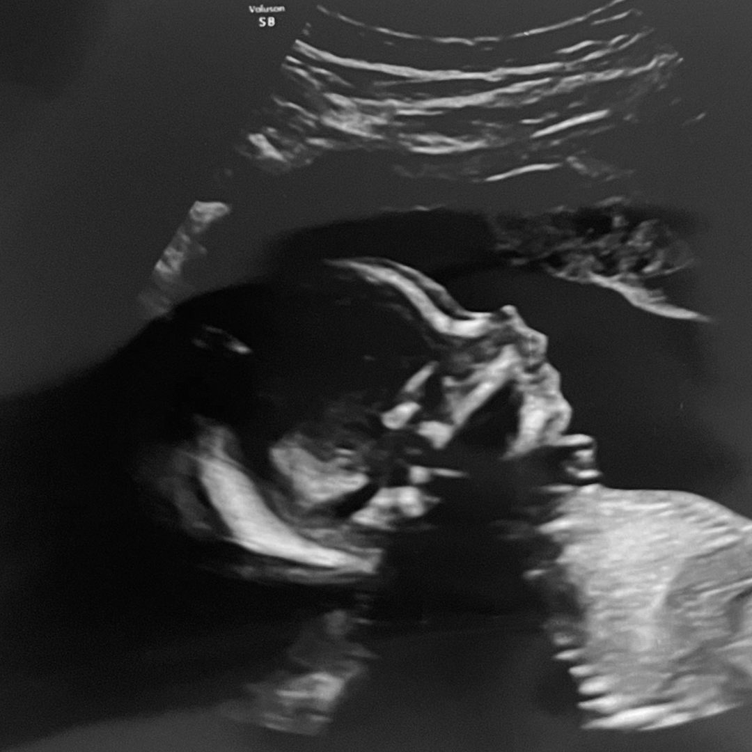 Photo shared by Hannah for their Babylist baby registry.