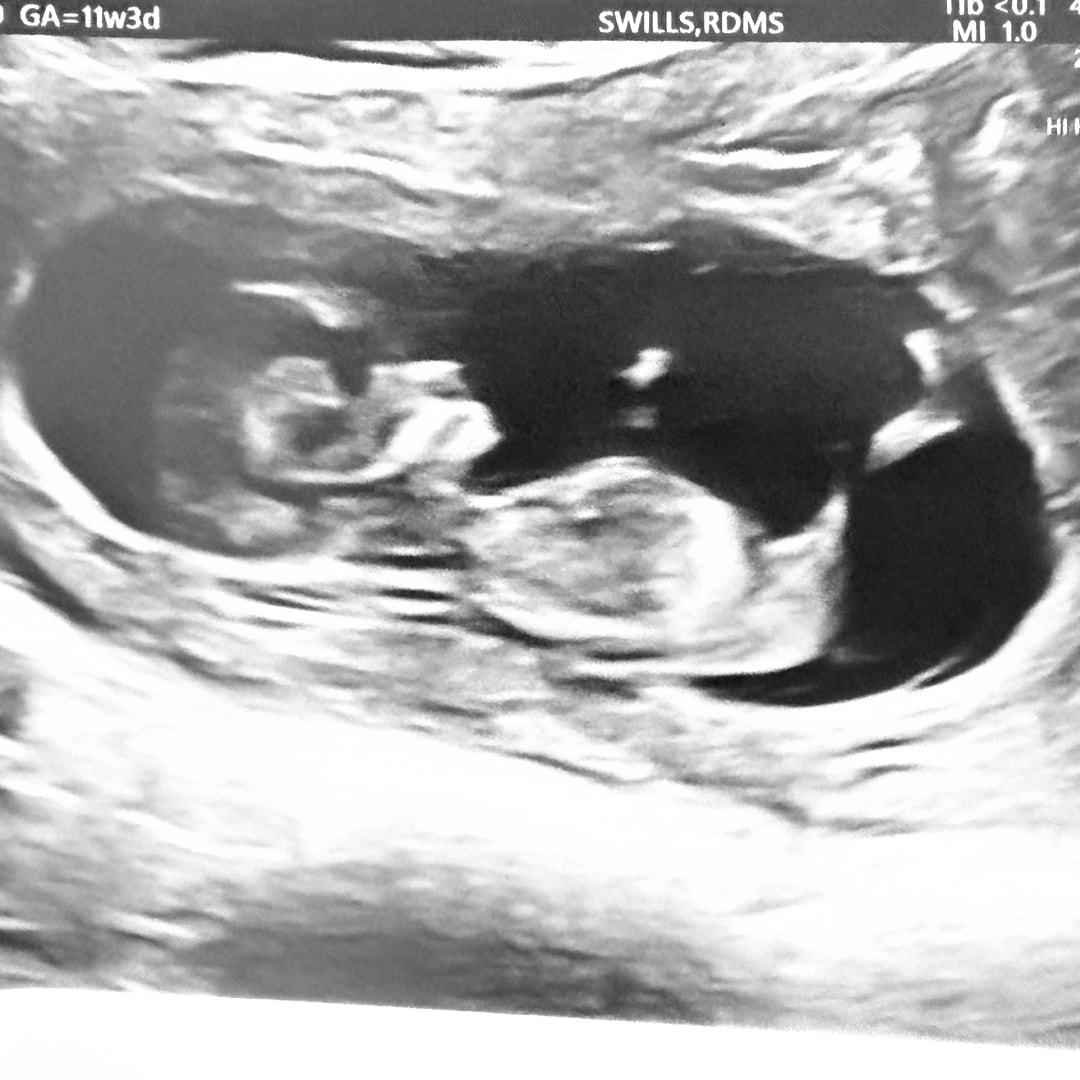 Photo shared by Devon for their Babylist baby registry.