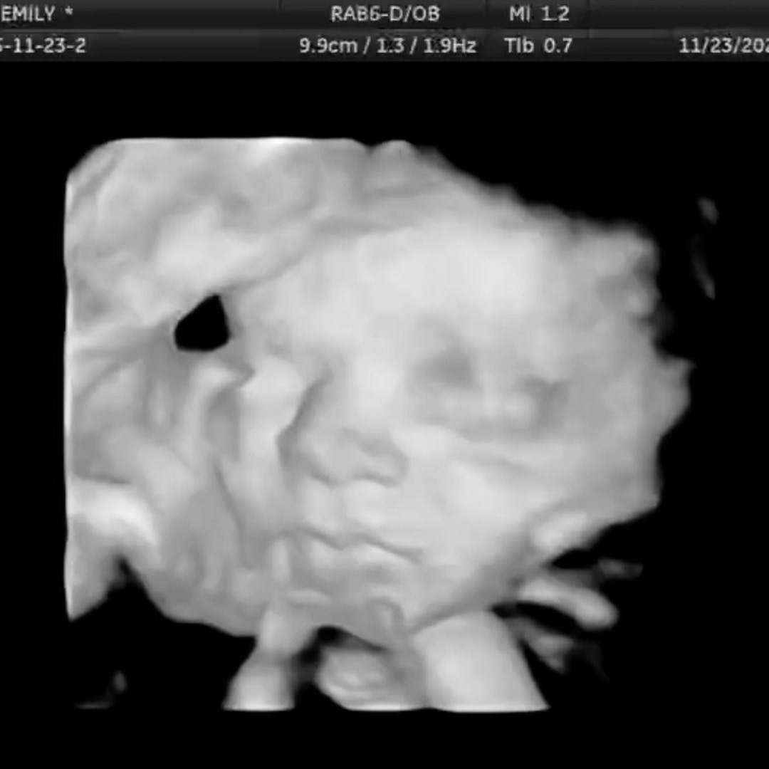 Photo shared by Emily for their Babylist baby registry.