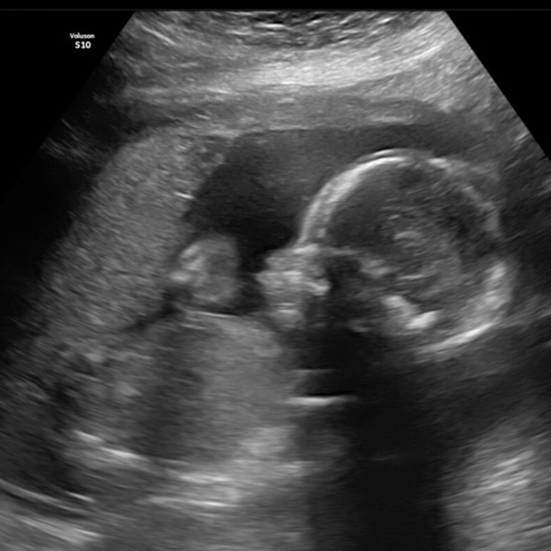 Photo shared by Alanna for their Babylist baby registry.