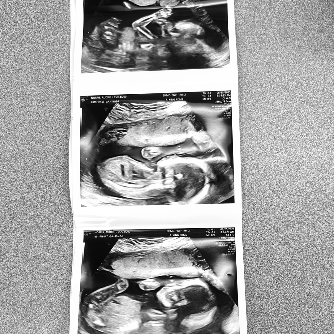 Photo shared by Audrie for their Babylist baby registry.
