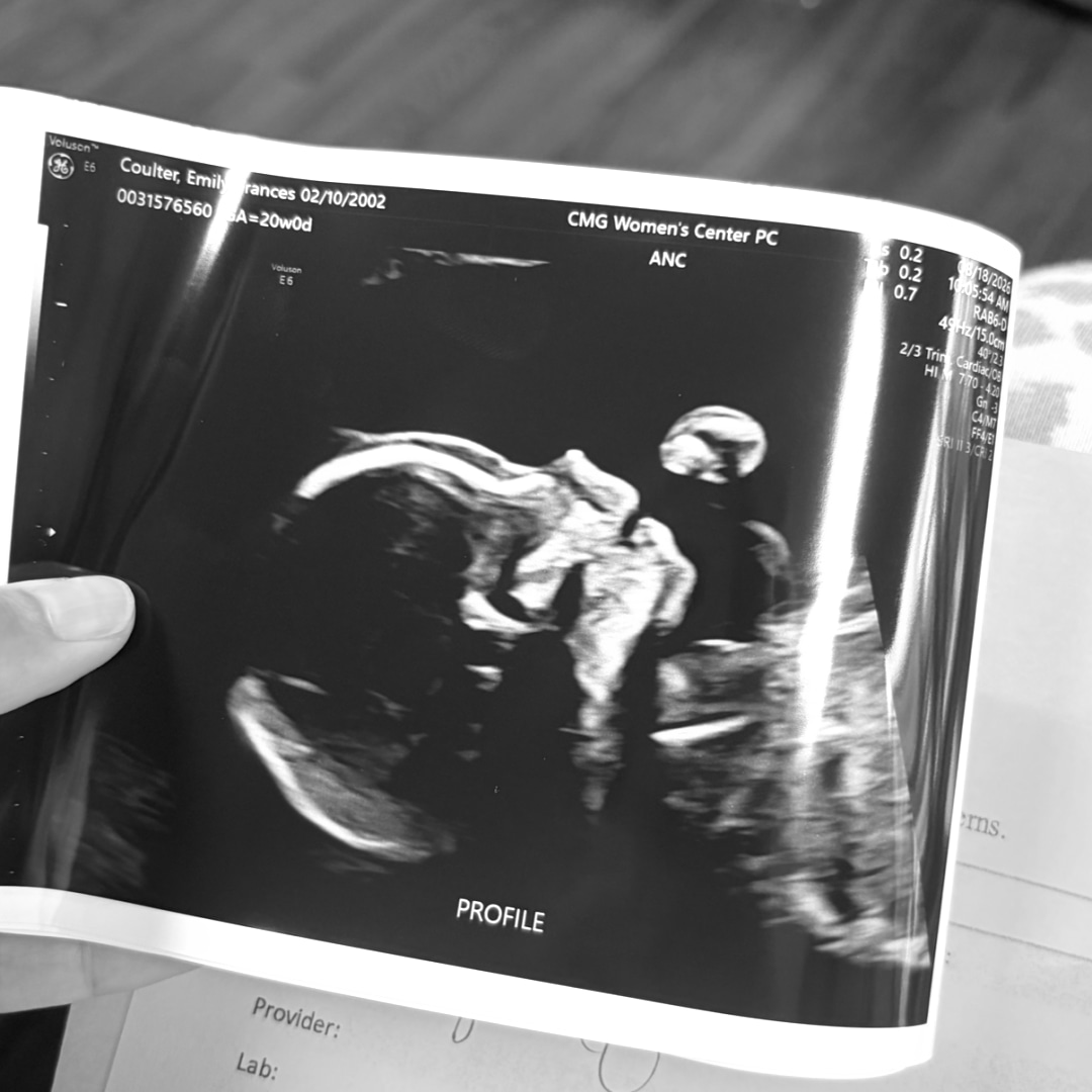 Photo shared by Emily for their Babylist baby registry.