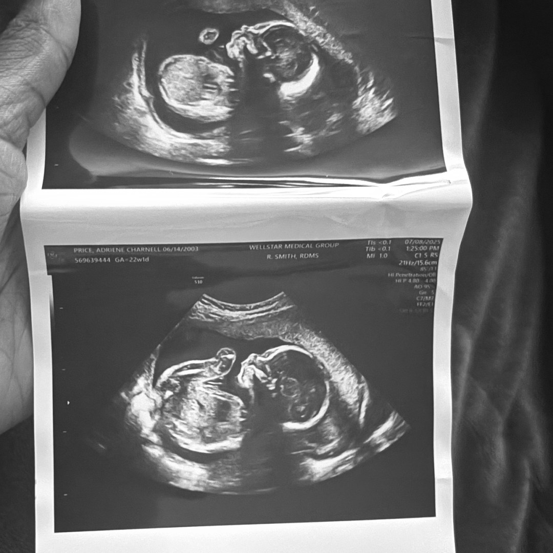 Photo shared by Adriene for their Babylist baby registry.