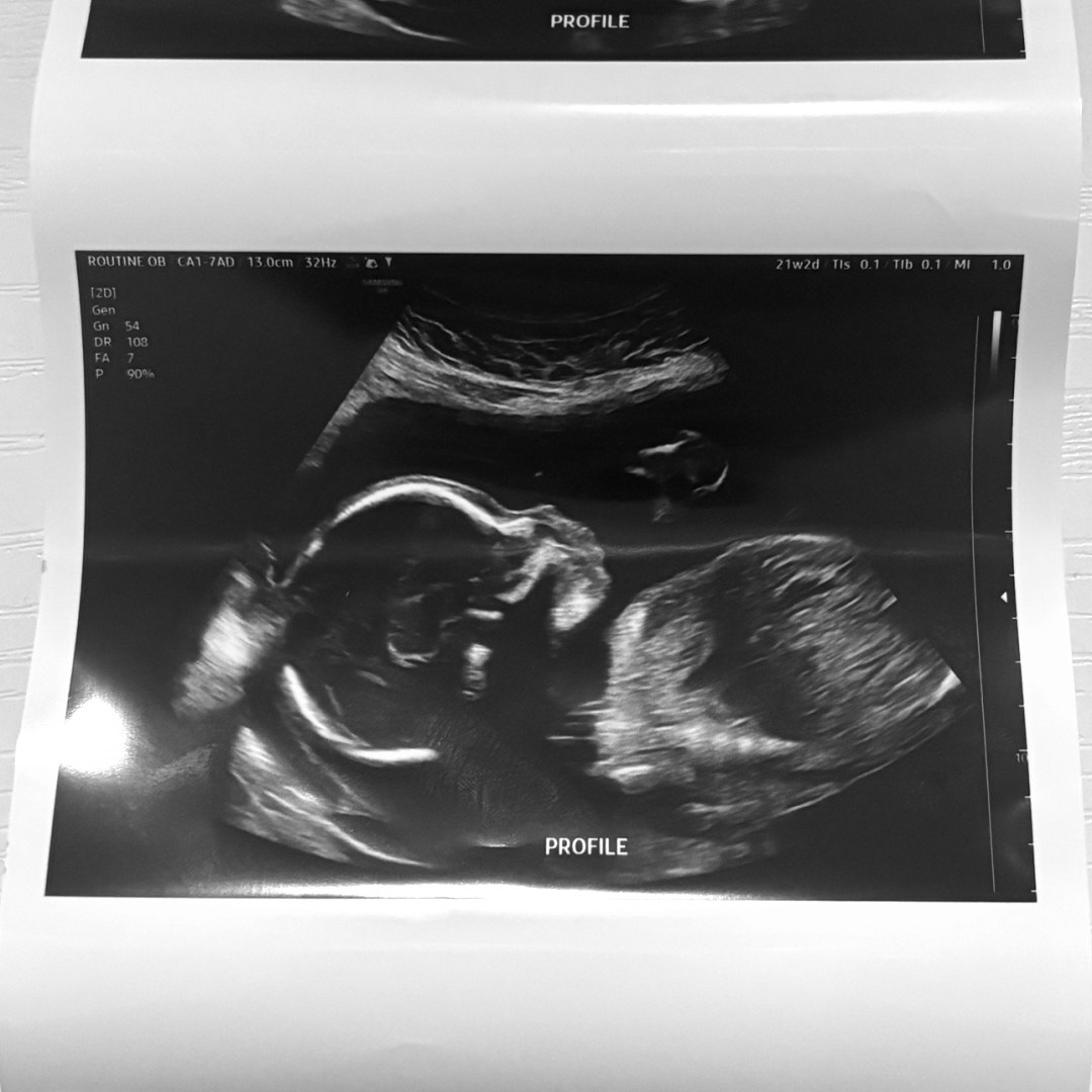 Photo shared by Jaylee for their Babylist baby registry.