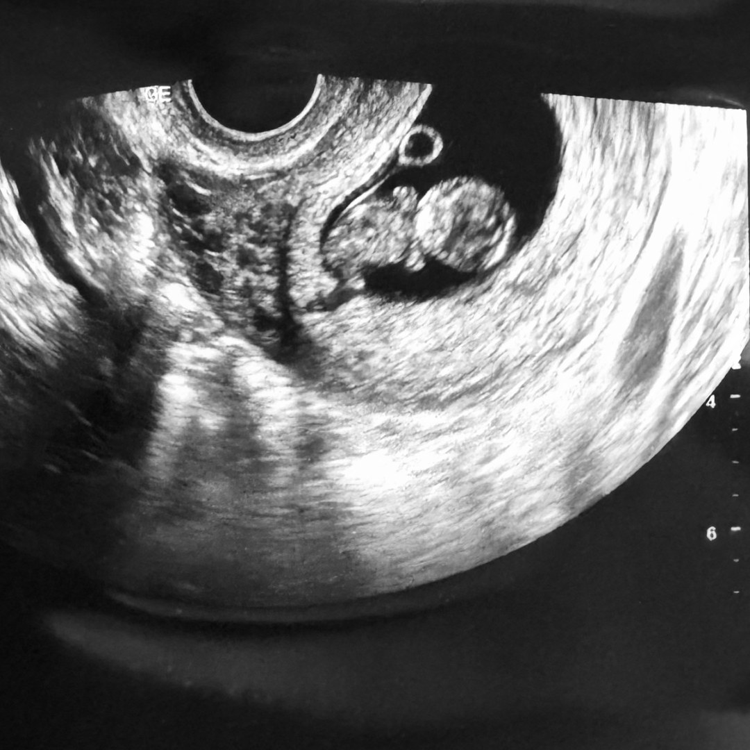 Photo shared by Ariana for their Babylist baby registry.