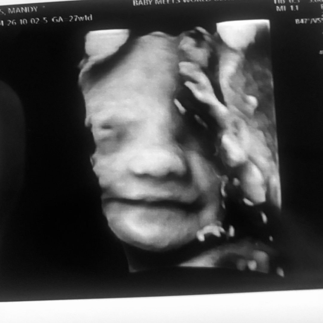 Photo shared by Mandy for their Babylist baby registry.