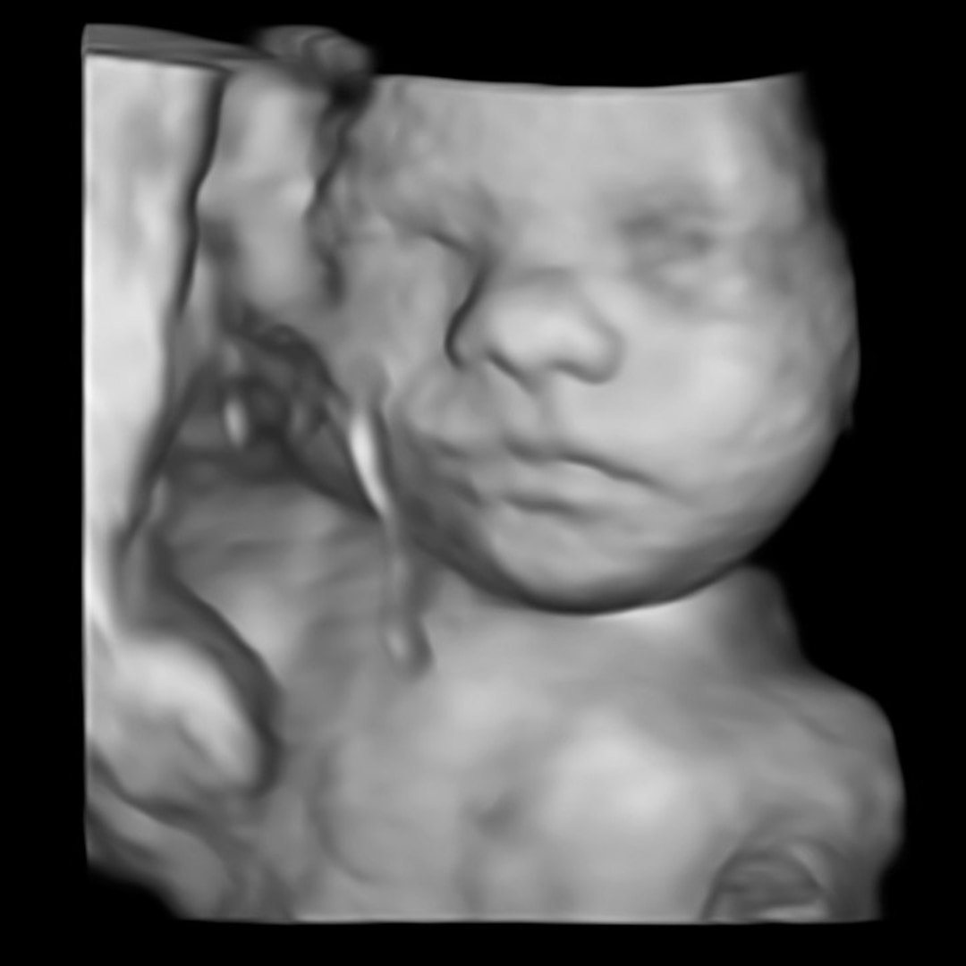 Photo shared by Anna for their Babylist baby registry.