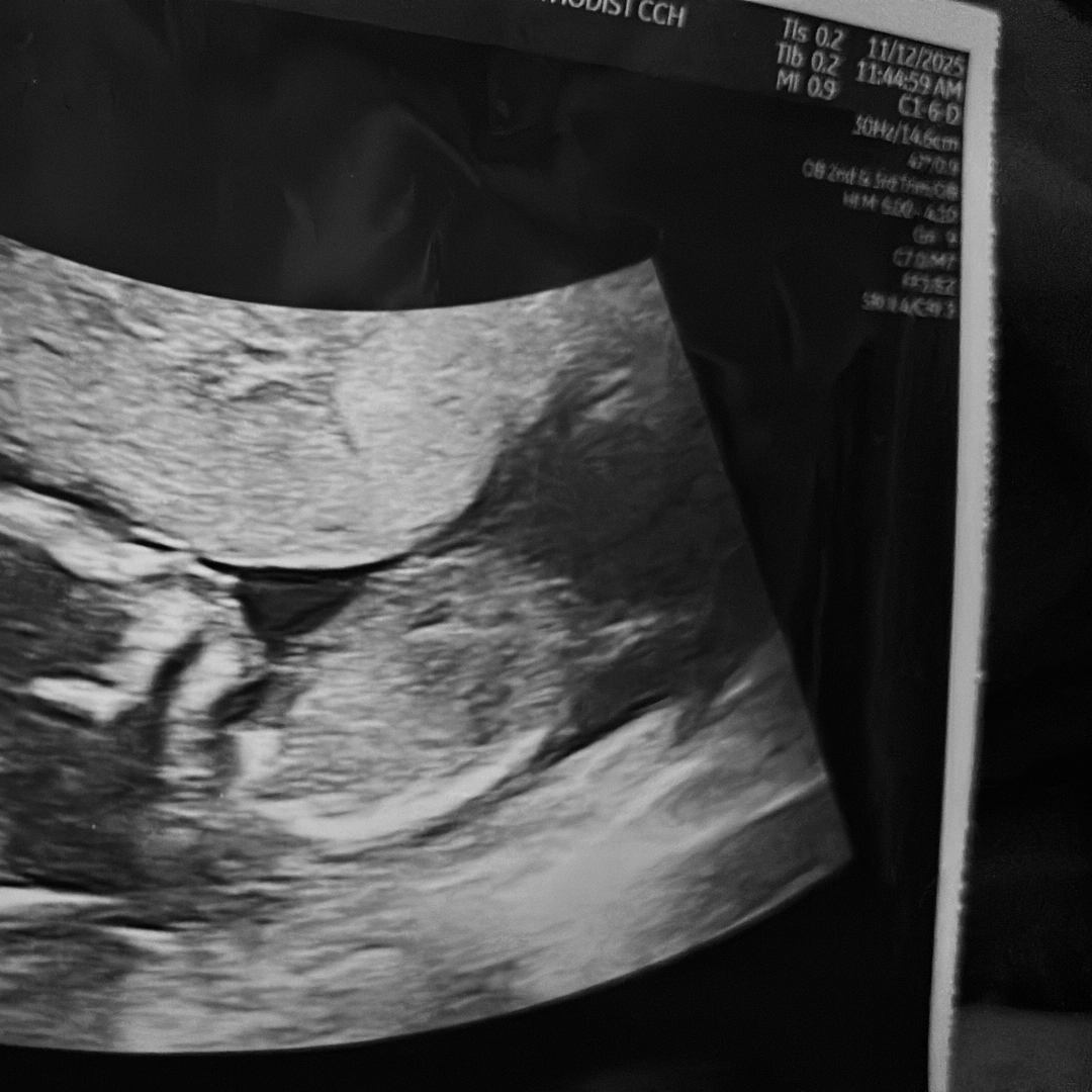 Photo shared by Jaden for their Babylist baby registry.