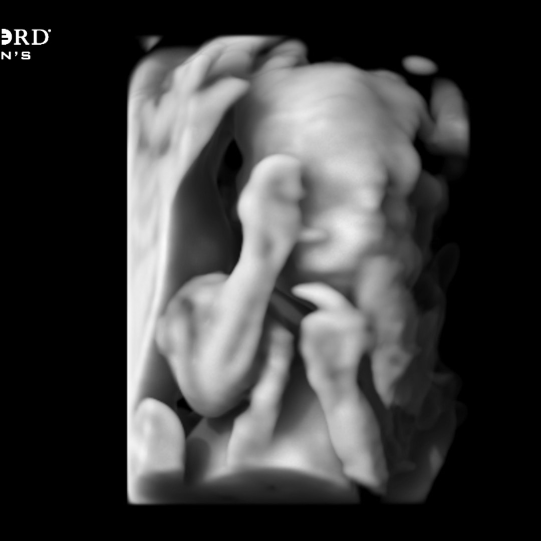 Photo shared by Madison for their Babylist baby registry.