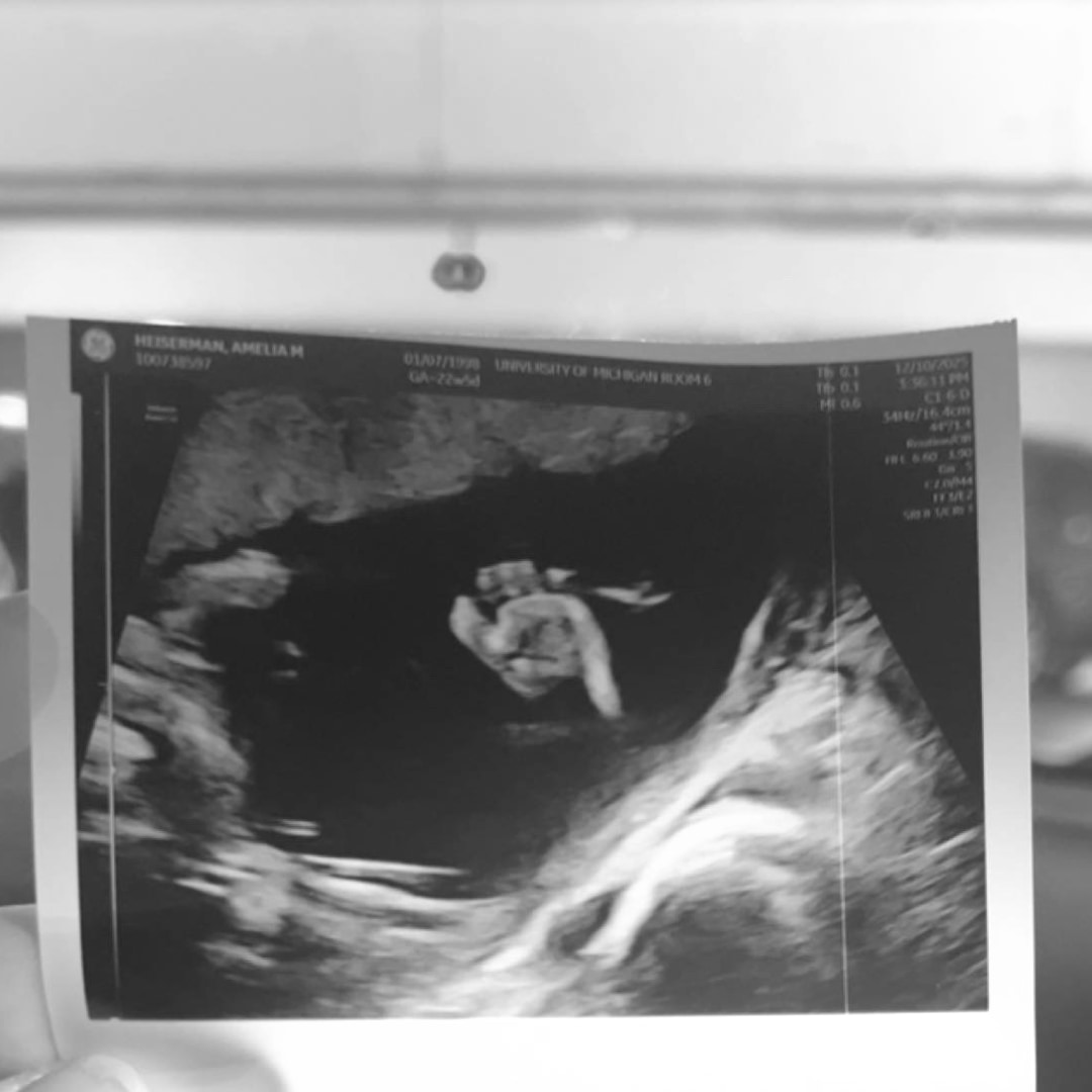 Photo shared by Amelia for their Babylist baby registry.