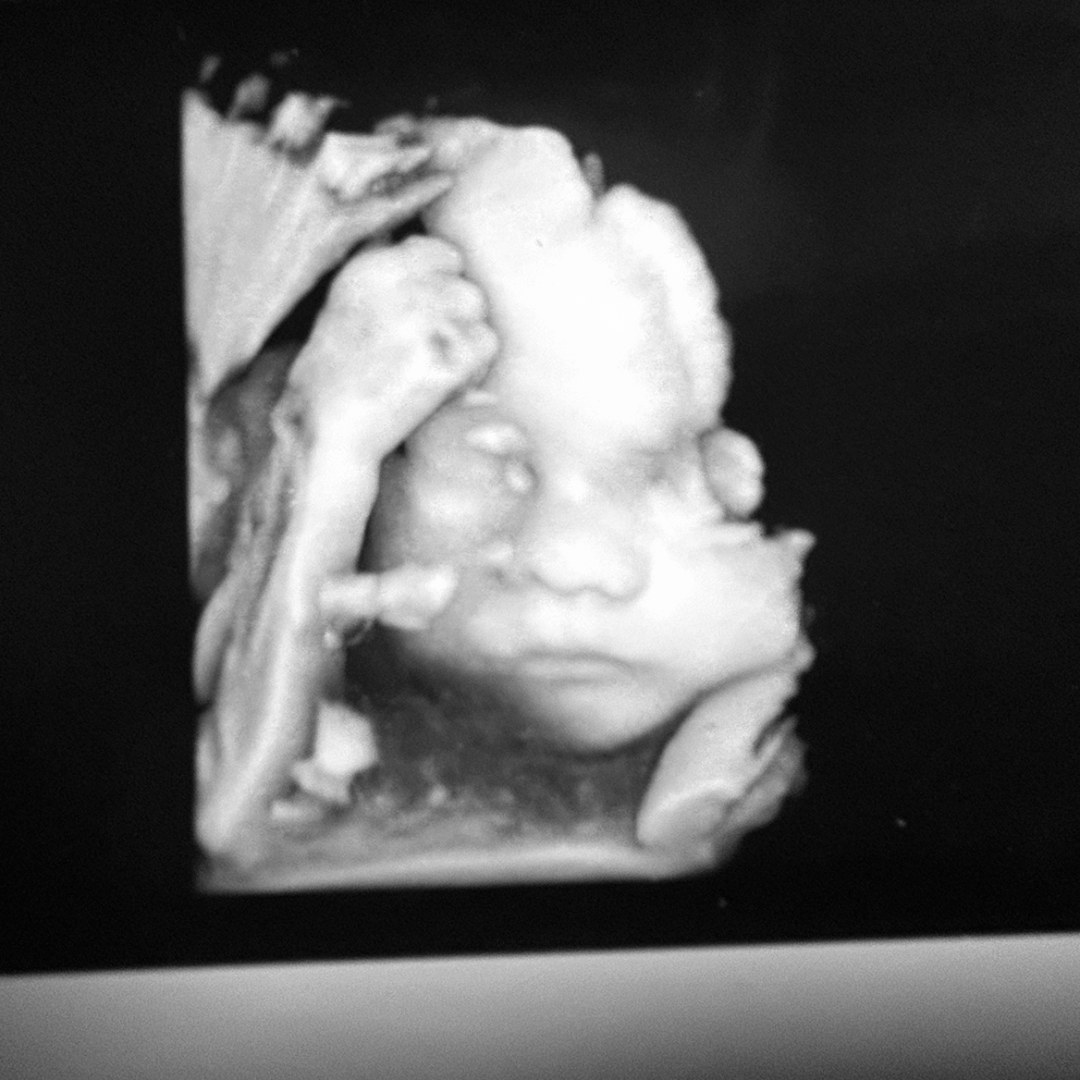 Photo shared by Skylar for their Babylist baby registry.