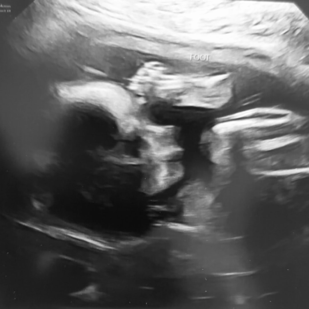 Photo shared by Courtney for their Babylist baby registry.