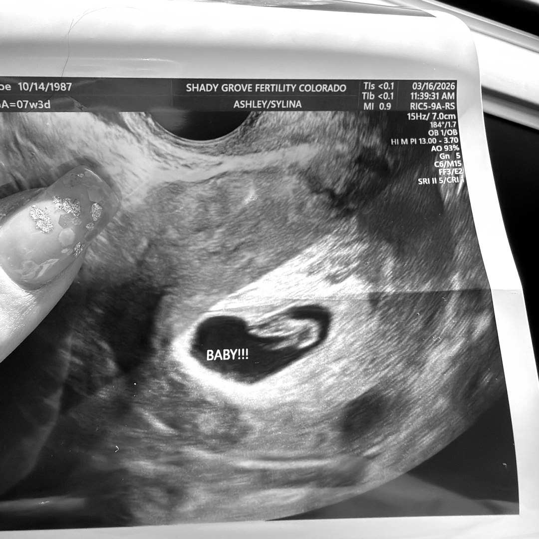 Photo shared by Zoe for their Babylist baby registry.
