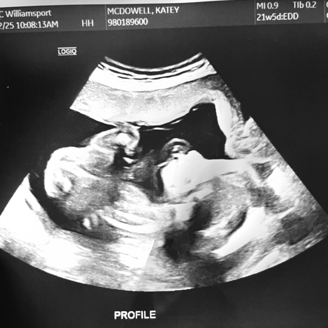 Photo shared by Katey for their Babylist baby registry.