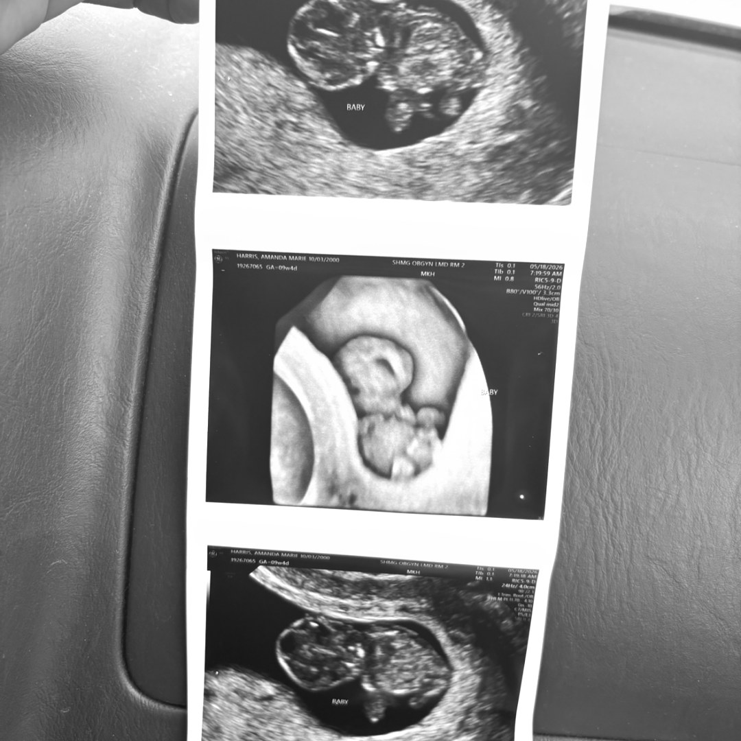 Photo shared by Amanda for their Babylist baby registry.