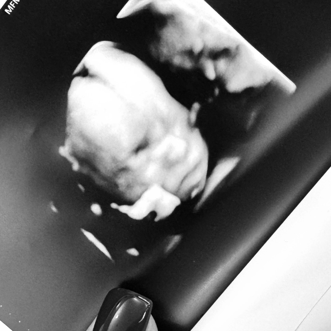 Photo shared by Elle for their Babylist baby registry.