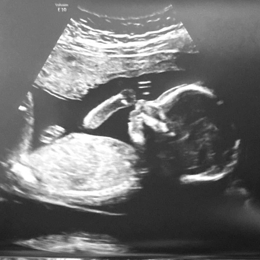 Photo shared by Alli for their Babylist baby registry.