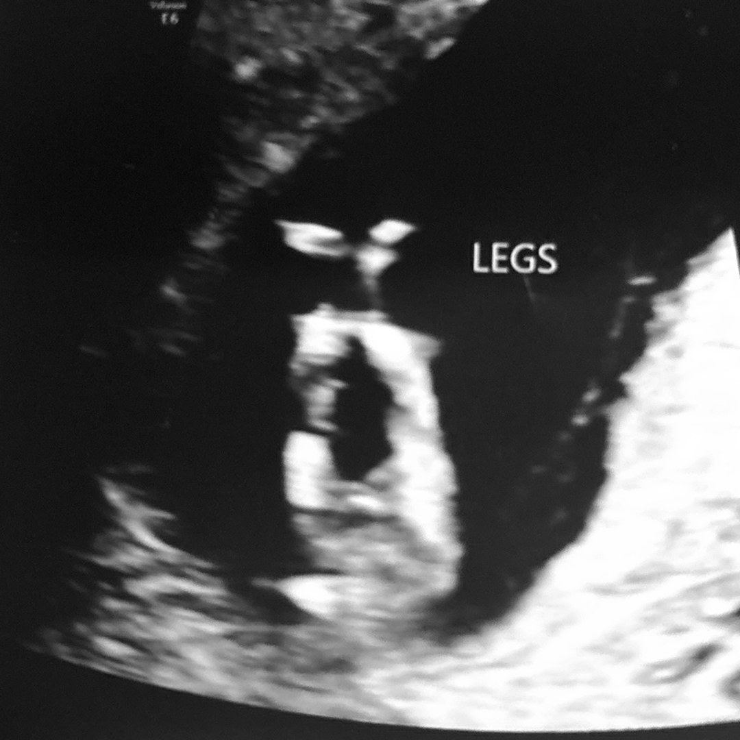 Photo shared by Alexis for their Babylist baby registry.