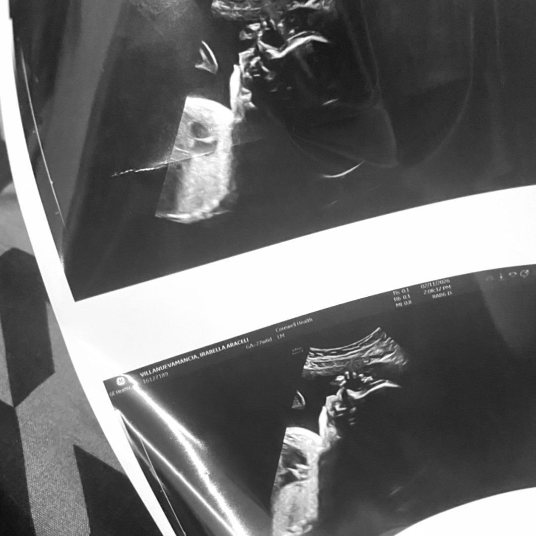 Photo shared by Irabella for their Babylist baby registry.