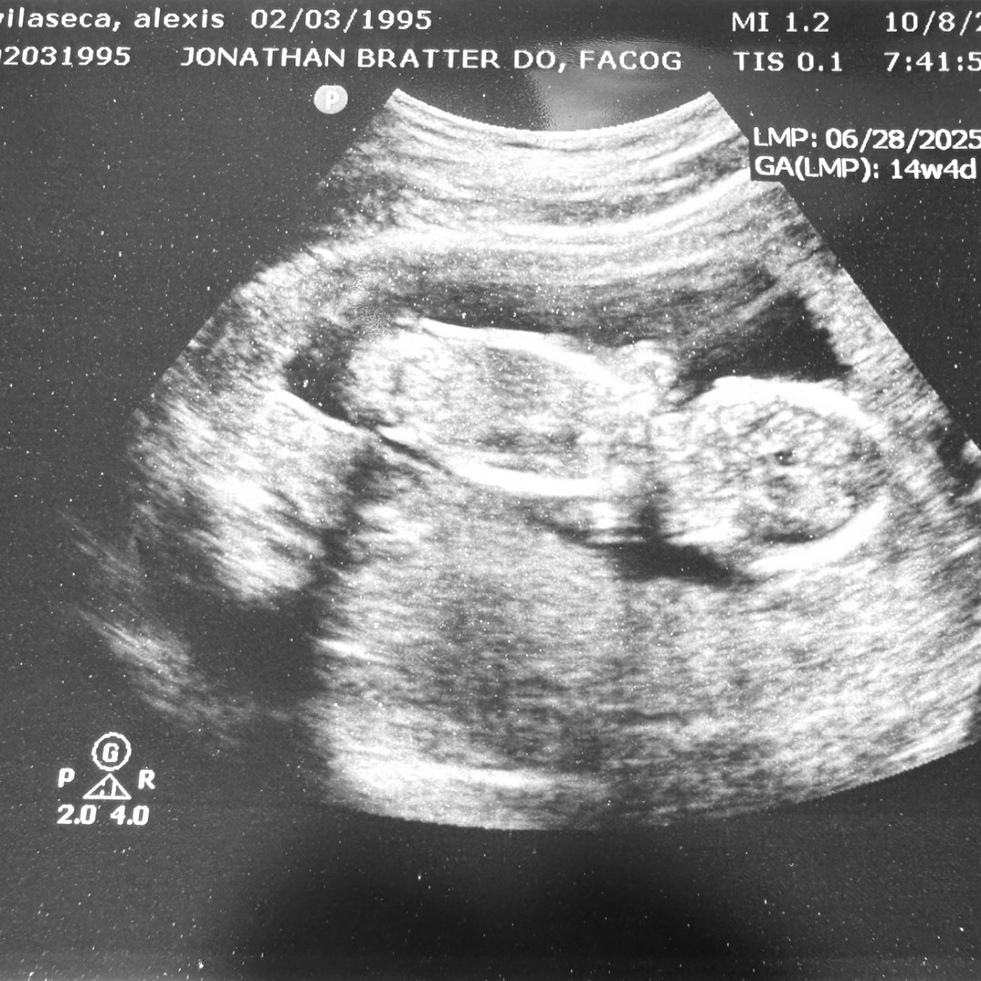 Photo shared by Lexi for their Babylist baby registry.