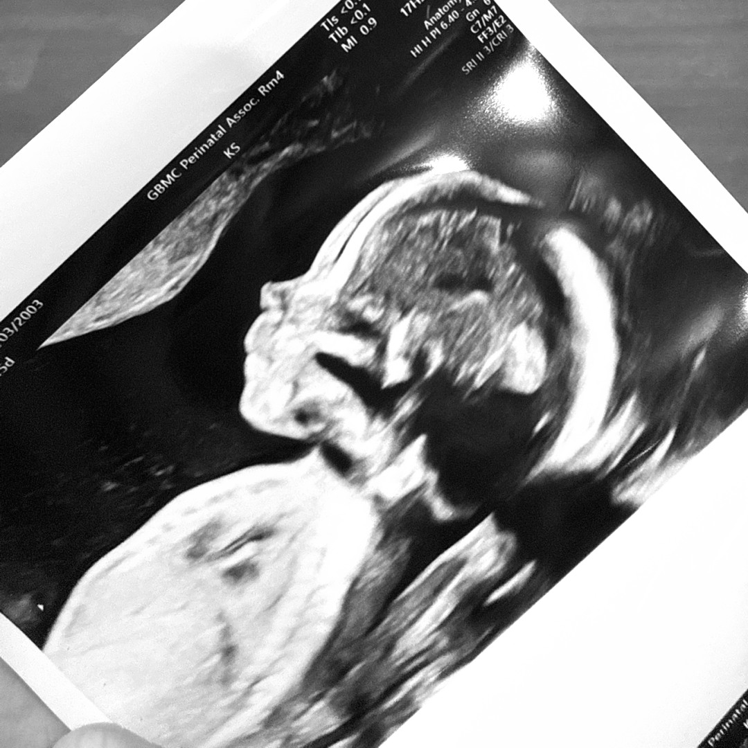 Photo shared by Rachel for their Babylist baby registry.