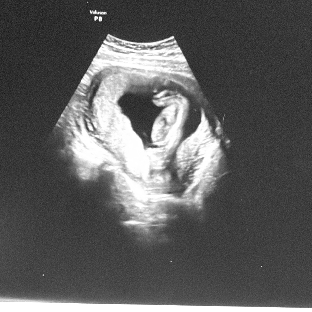 Photo shared by Alexandra for their Babylist baby registry.