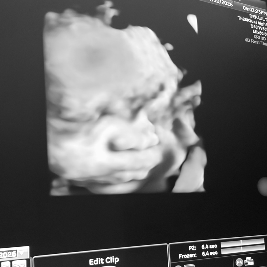 Photo shared by Rocky for their Babylist baby registry.