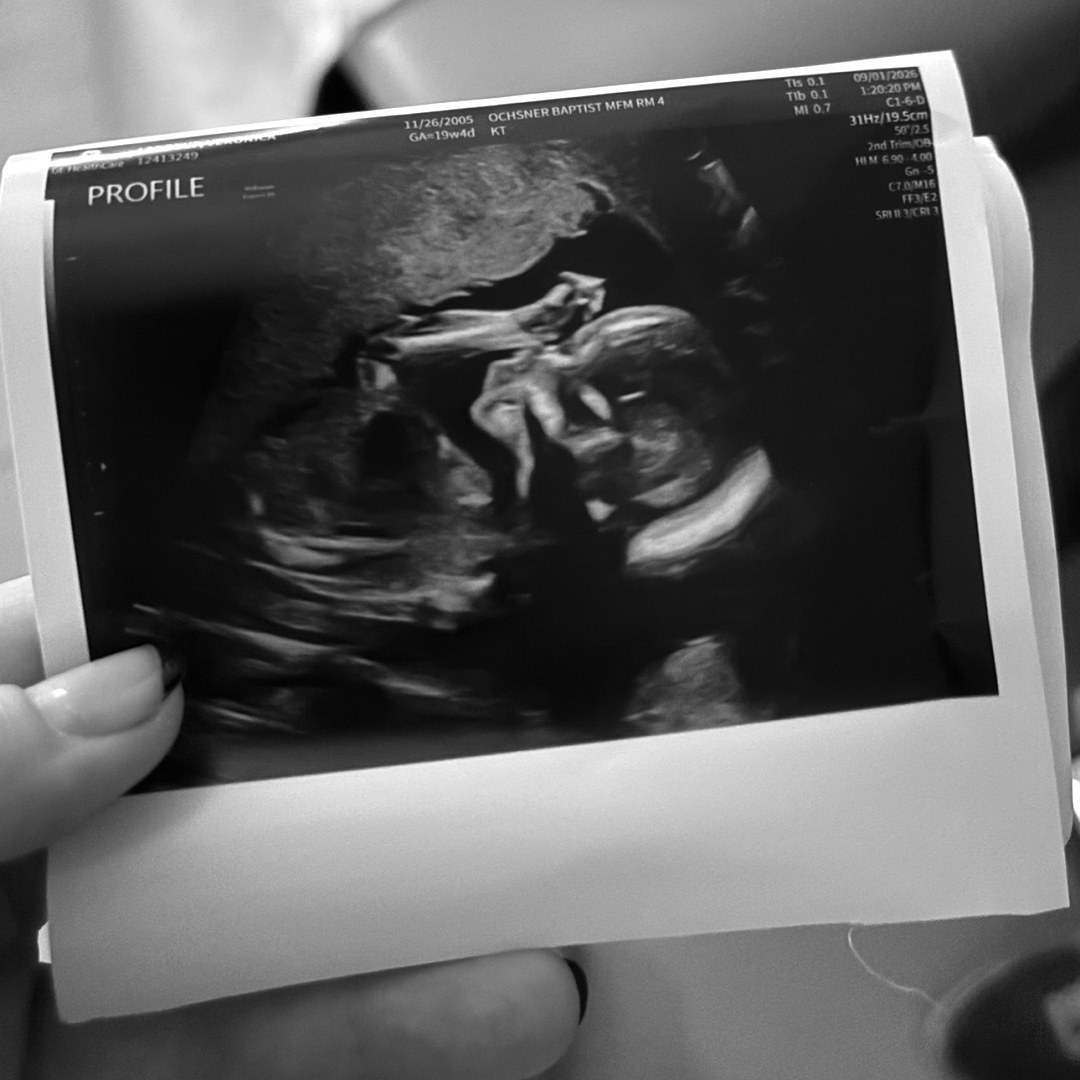 Photo shared by Veronica for their Babylist baby registry.
