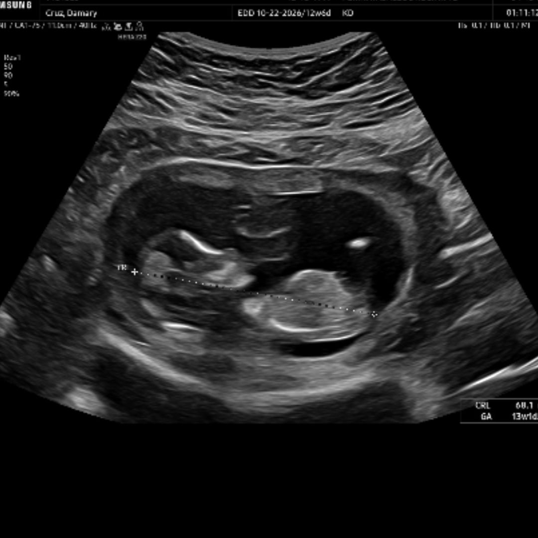 Photo shared by Damary for their Babylist baby registry.