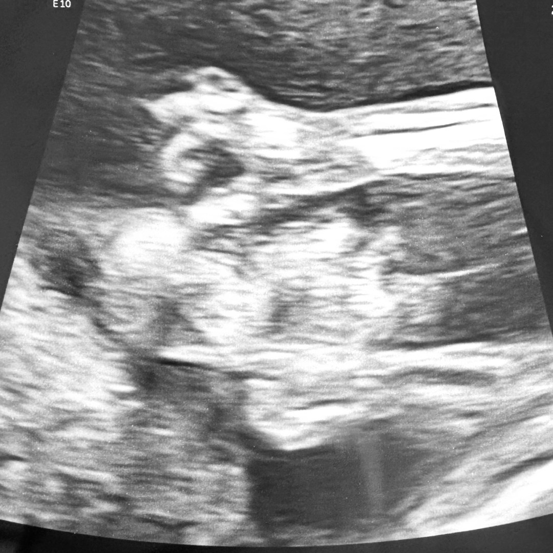 Photo shared by Allyson for their Babylist baby registry.