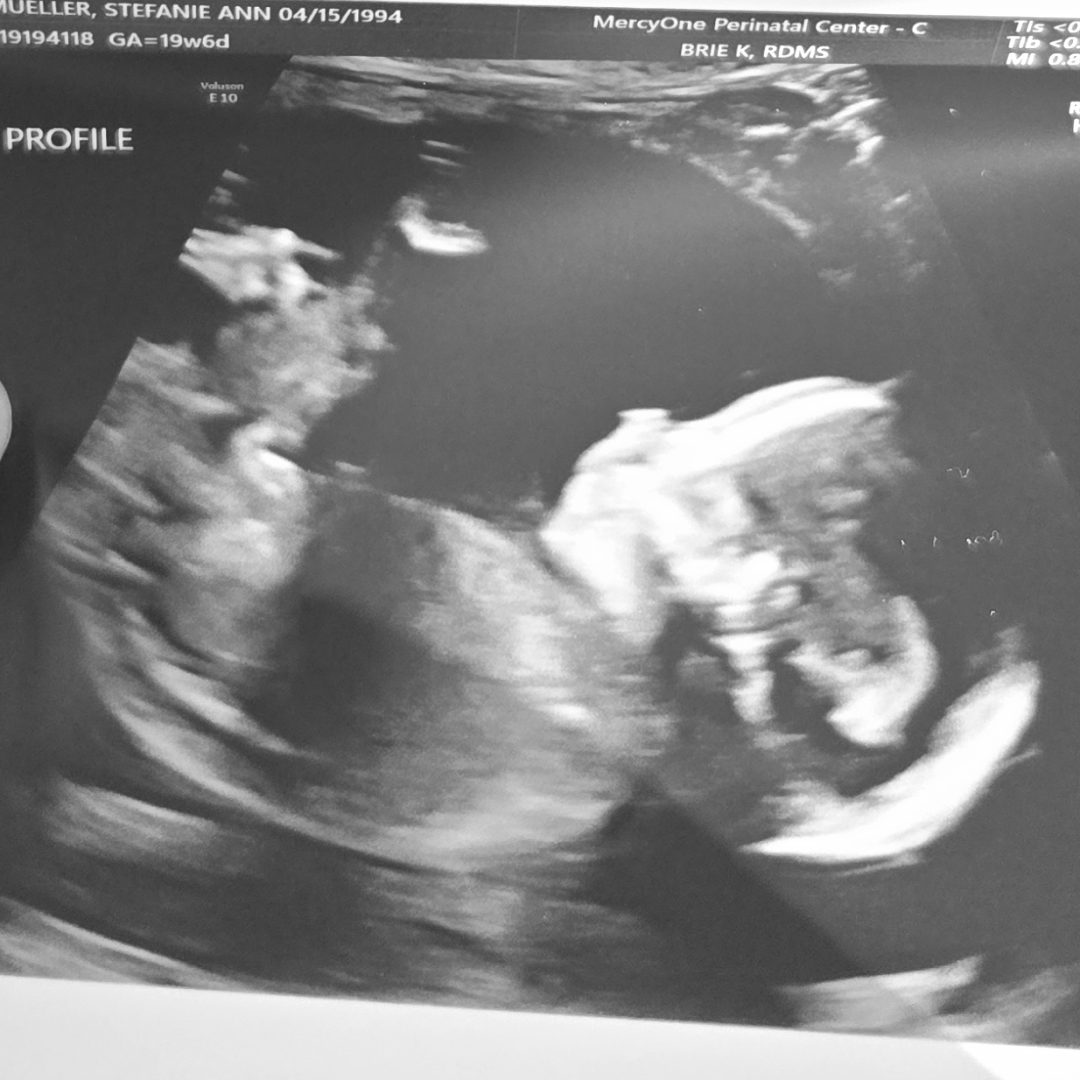 Photo shared by Stefanie for their Babylist baby registry.