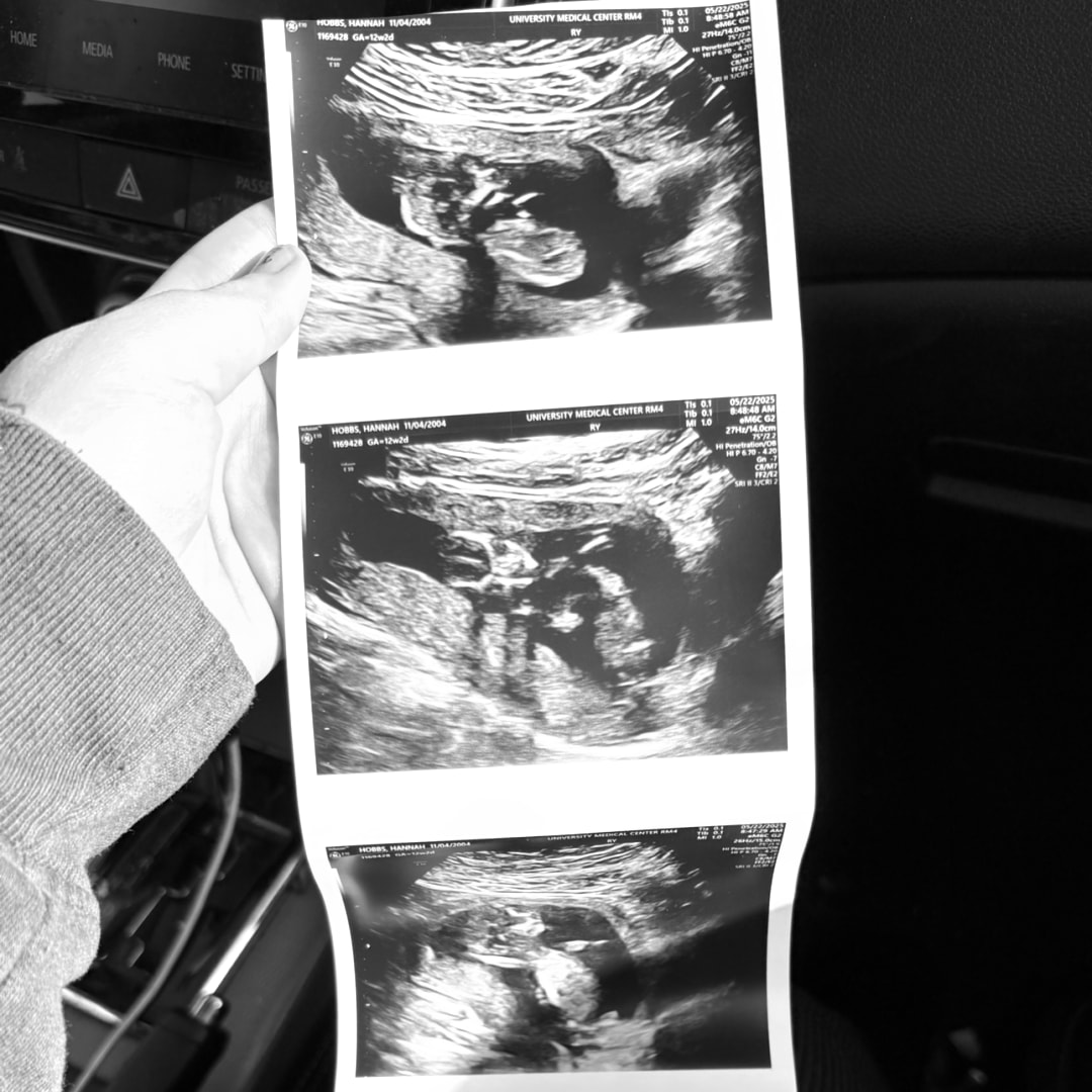 Photo shared by Hannah for their Babylist baby registry.