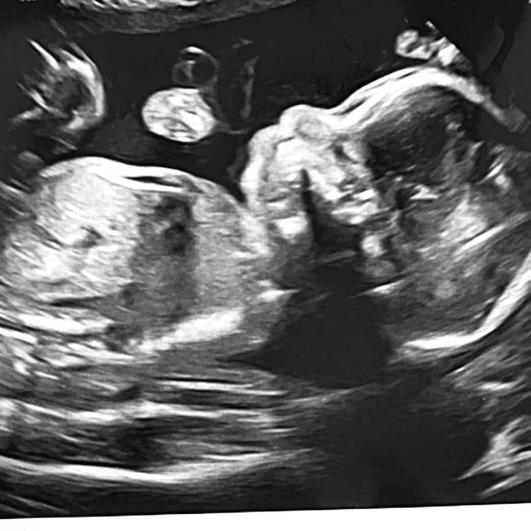 Photo shared by Magdalen for their Babylist baby registry.