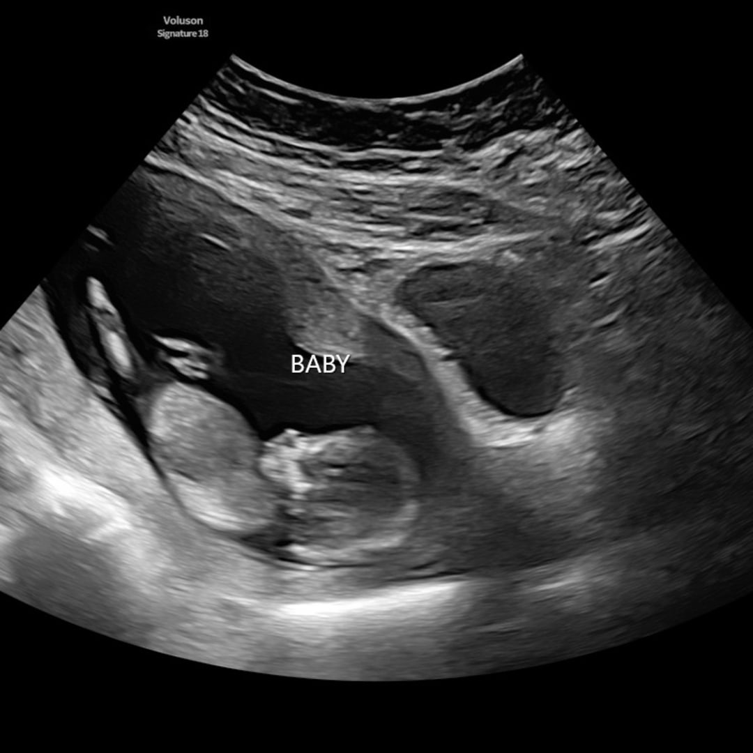 Photo shared by Tammy for their Babylist baby registry.