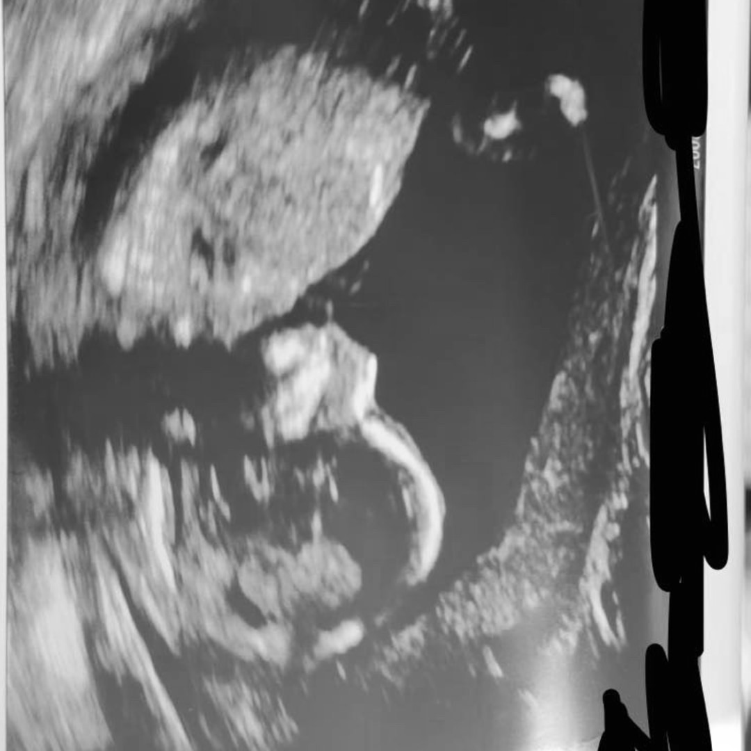 Photo shared by Kyrah for their Babylist baby registry.