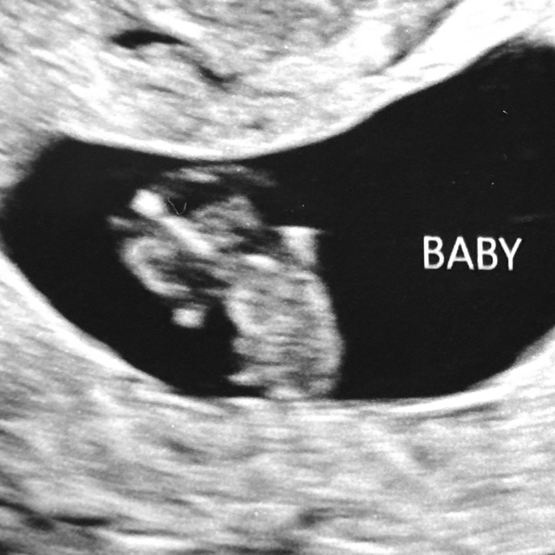 Photo shared by Autumn for their Babylist baby registry.