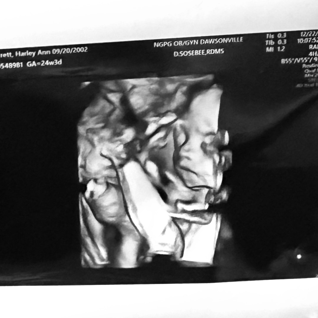 Photo shared by Harley for their Babylist baby registry.