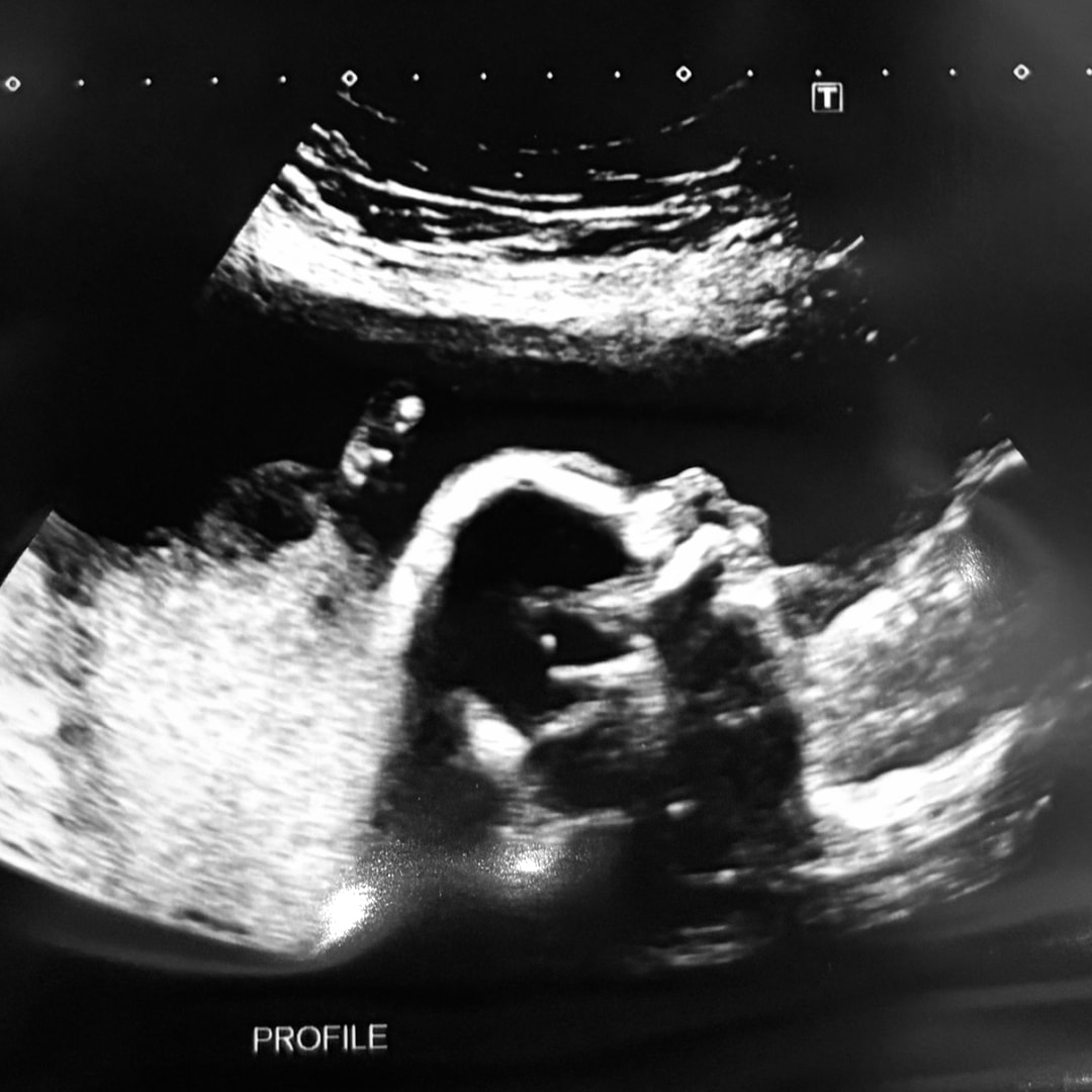 Photo shared by Kaitlyn for their Babylist baby registry.